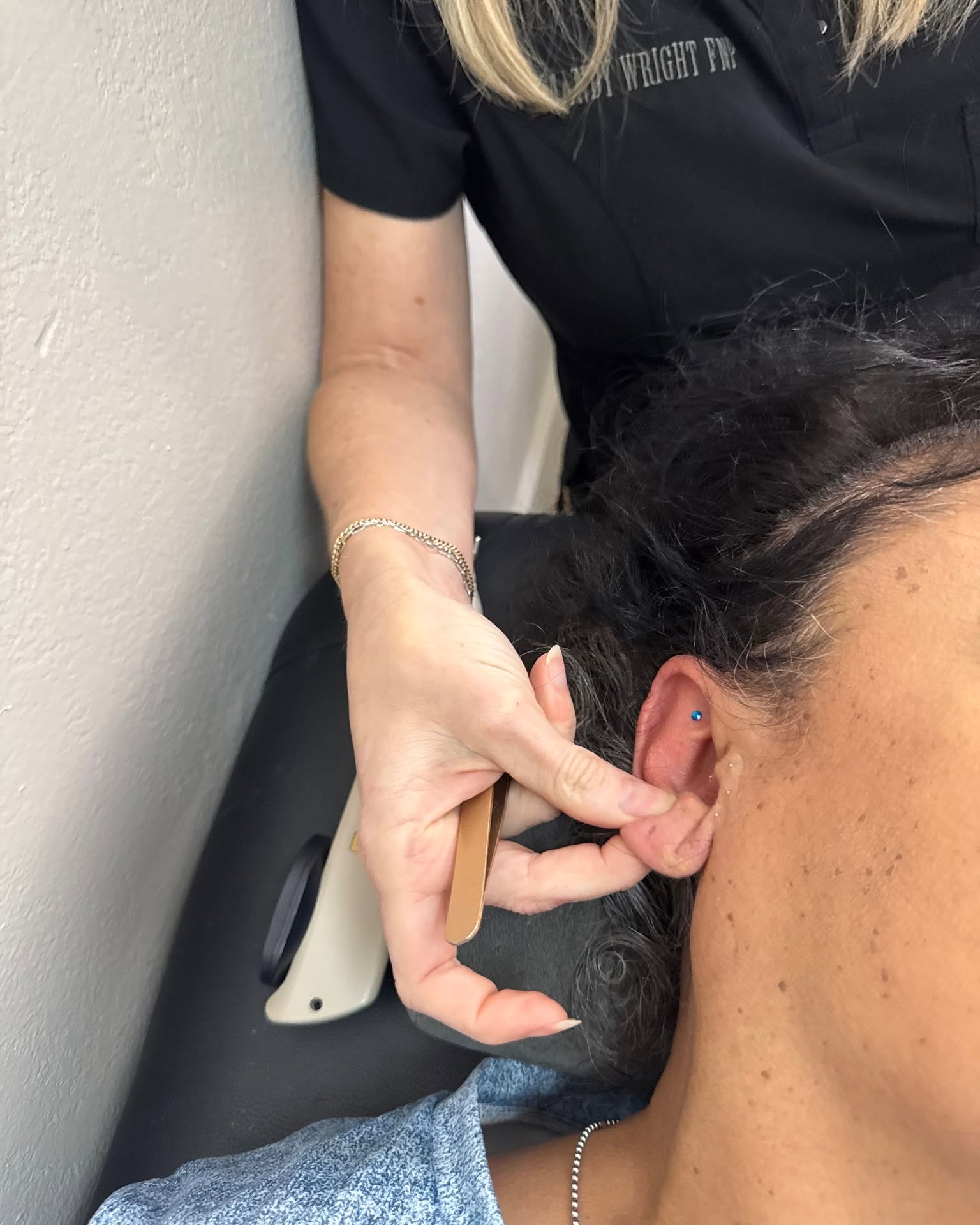 Ear seed placement during an auriculotherapy visit
