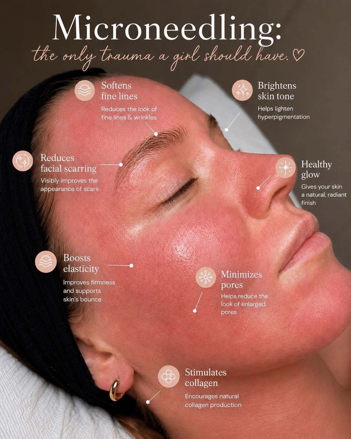 Microneedling skin benefits for facial aesthetics